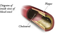 blood vessel